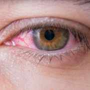Eine Frau rammte sich bei einem Unfall ihren Eyeliner ins Auge (Symbolbild). Eine Frau rammte sich bei einem Unfall ihren Eyeliner ins Auge (Symbolbild).