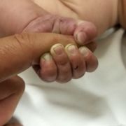 Ein fünf Monate altes Baby hat mindestens neun Stunden lang begraben unter Ästen und Geröll in den Bergen des US-Bundesstaates Montana überlebt. Ein fünf Monate altes Baby hat mindestens neun Stunden lang begraben unter Ästen und Geröll in den Bergen des US-Bundesstaates Montana überlebt.