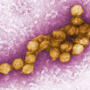 Dieses Foto zeigt eine elektronenmikroskopische Aufnahme des West-Nil-Virus. Vier Wochen nach dem bundesweit ersten Fall ist das West-Nil-Virus (WNF) erstmals in Mecklenburg-Vorpommern aufgetaucht. Dieses Foto zeigt eine elektronenmikroskopische Aufnahme des West-Nil-Virus. Vier Wochen nach dem bundesweit ersten Fall ist das West-Nil-Virus (WNF) erstmals in Mecklenburg-Vorpommern aufgetaucht.