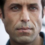 Hoffnung auf Zuflucht in Deutschland: Mohammad Hassanzadeh Kalali ließ sich Anfang Juni in Würzburg aus Protest seinen Mund zunähen. Hoffnung auf Zuflucht in Deutschland: Mohammad Hassanzadeh Kalali ließ sich Anfang Juni in Würzburg aus Protest seinen Mund zunähen.