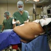 Im Kampf gegen chronisches Übergewicht sehen viele adipöse Patienten nach zahlreichen erfolglosen Diäten und Therapien in einer Magenverkleinerung die letzte Lösung. Im Kampf gegen chronisches Übergewicht sehen viele adipöse Patienten nach zahlreichen erfolglosen Diäten und Therapien in einer Magenverkleinerung die letzte Lösung.