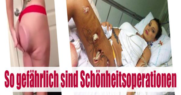 Das Festival chocha und die Sommersprosse