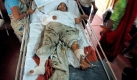 Eines der verletzten Opfer in einem Krankenhaus der westindischen Metropole. Schon kurz nach dem Attentat richtete sich der Verdacht auf islamistische Terrorzellen, die die Anschläge von Pakistan aus vorbereiteten. Indien macht die pakistanische Terrorgruppe Lashkar-e-Taiba (LeT) für die Attentate verantwortlich. Foto: dpa