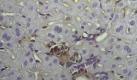 Lebergewebeschnitt mit einer seneszenten Leberzelle genau in der Bildmitte: Ein gesundes und leistungsfähiges Immunsystem kann potenzielle Krebsvorläuferzellen in der Leber frühzeitig entdecken und abtöten. Foto: Helmholtz-Zentrum für Infektionsforschung, Braunschweig Foto: dpa