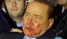 Das italienische Fernsehen strahlte Bilder vom verletzen Berlusconi aus. Ein Angreifer hatte ihn beim Autogramme schreiben mit der Faust oder einem Gegenstand niedergestreckt. Foto: dpa