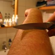 Ritzen erkennen (Foto)