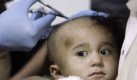 Der zweijährige Malik wurde im Militärkrankenhaus in Kandahar behandelt, nachdem ein Dach über ihm zusammengebrochen war und ihn am Kopf verletzte. Foto: ap