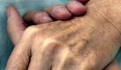 Eine stützende Hand:Todkranke Patienten wollen in den letzten Tagen ihres Lebens nicht allein sein, sie wollen ohne Schmerzen sterben. Foto: ddp