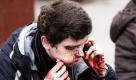 Ein Opfer der Bombenanschläge in Moskau wischt sich Blut aus dem Gesicht. Bei zwei Explosionen am frühen Morgen sind mindestens 37 Menschen getötet worden. Foto: dpa