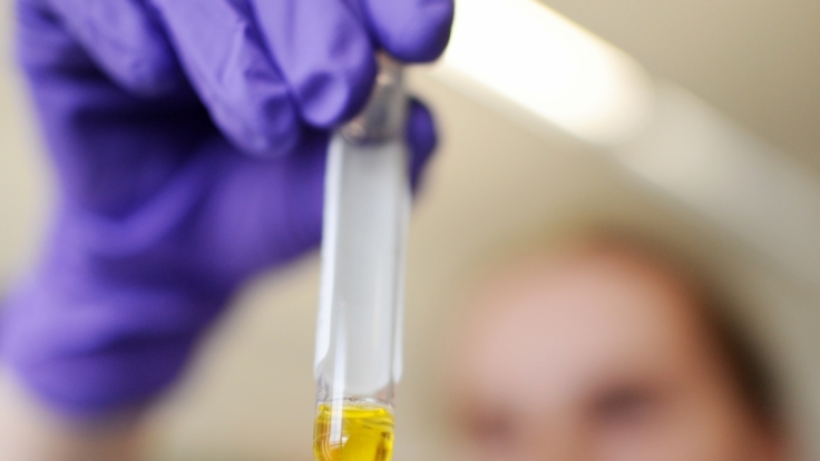 Die Weltgesundheitsorganisation WHO warnt vor einer mysteriösen Seuche namens