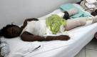 ARCHIV - Eine Frau, der ihr linkes Bein amputiert worden ist, liegt im General Hospital in Port-Au-Prince in Haiti (Archivfoto vom 18.01.2010). Hilfsorganisationen schlagen Alarm: Noch völlig unklar sei, wie zehntausende Amputierte künftig versorgt werden, dringend müssten lokale Orthopädie-Techniker ausgebildet werden. «Sonst wird Haiti langfristig zum Land der Amputierten», warnt etwa Marcel Baeriswyl, Orthopädie-Fachmann der Johanniter-Unfall-Hilfe. Gemeinsam mit anderen Organisationen nehmen die Johanniter nach eigenen Angaben etwa 100 Amputationen am Tag vor. «Zum Teil geht es da zu wie früher: Auf Piratenschiffen hat man den Verletzten ein Stück Holz zwischen die Zähne gesteckt und einfach abgeschnitten», beschreibt Baeriswyl. Foto: ORLANDO BARRIA (zu dpa-KORR 'Haiti/Erdbeben/Gesundheit') +++(c) dpa - Bildfunk+++ 
 Foto: dpa