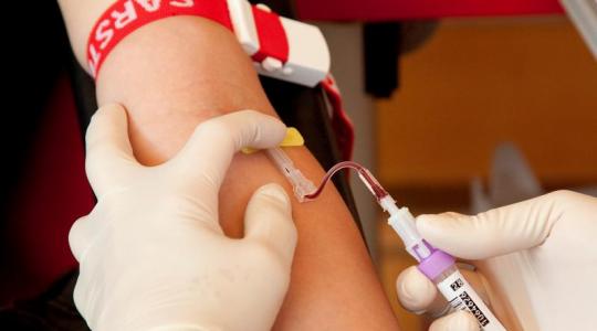Patienten m&uuml;ssen eigene Blutgruppe nicht kennen (Foto)