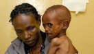 Die Hunger-Gefahr inÄthiopien ist noch immer nicht gebannt. Hier wartet ein unterernährtes Kind mit seiner Mutter im Krankenhaus von Dilla auf Behandlung. Foto: dpa
