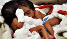 In Islamabad in Pakistan wurden noch namenlose siamesische Zwillinge geboren. Die Kinder kamen einige Tage zu früh zur Welt, jedoch ist ihr Gesundheitszustand stabil. Foto: ap