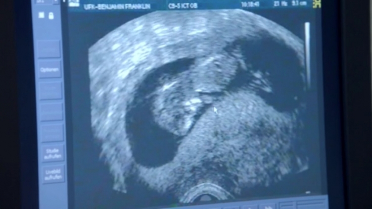 Die Ultraschalluntersuchung ist eindeutig: Maren erwartet ein Baby.