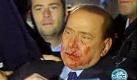 Am 13. Dezember 2009 wird der italienische Ministerpräsident Opfer der Attacke eines jungen Mannes. Dieser bewirft ihn mit einer Miniaturausgabe des Mailänder Doms. Berlusconi erleidet Prellungen im Gesicht und einen Nasenbeinbruch. Foto: dpa