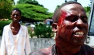 Bei Zusammenstößen zwischen somalischen Truppen der Afrikanischen Union und Aufständischen in Mogadischu wurden mehrere Menschen von Granatensplittern verletzt. Foto: ap