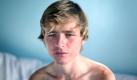 Die Porträt-Aufnahmen führt Laura Pannack aus Großbritannien mit ihrem Foto des magersüchtigen Teenagers Graham an, das sie für das Magazin des Guardian geschossen hat. Foto: Laura Pannack, The Guardian Weekend magazine