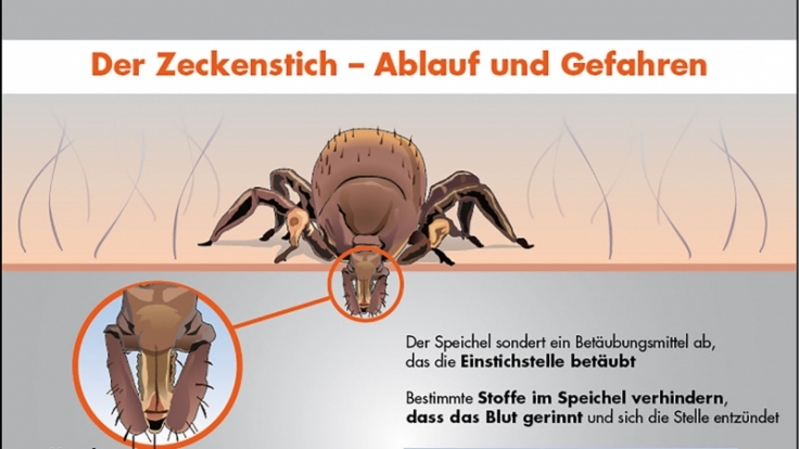 Ein Zeckenstich ist zwar nicht schmerzhaft, kann aber gefährliche Krankheiten verursachen.