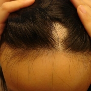 Das Öl für das Haar loreal elsew 6