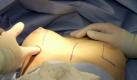 Bei einer Brustvergrößerung wird ein Silikon-Implantat eingesetzt Foto: Ulrich Perrey/ Archiv  Foto: dpa