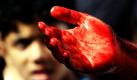 Ein Junge schaut erschrocken auf die blutige Hand eines schiitischen Muslim in Bahrain. Schiiten begehen das Ende eines 40-tägigen Trauerfestes zum Gedenken des Imam Hussein. Bestandteile des Trauerfestes sind gemeinsame Mahlzeiten und Gebete, bei denen auch selbstzugefügte Schnitte vorkommen können. Bahrain ist ein Königreich, bestehend aus Inseln im Persischen Golf. Foto: ap