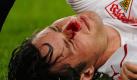 Christian Träsch, damals noch im Trikot des VfB Stuttgart, erwischte es 2009 in der Champions League im Spiel gegen die Glasgow Rangers. Foto: dapd