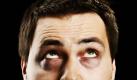 Können diese Augen lügen? An keiner anderen Körpergegend wird so schnell sichtbar, wenn die Haut um Hilfe schreit. Das Alarmsignal: Augenringe. News.de  zeigt, wie Sie die dunklen Ränder mit einfachen Hausmitteln wieder glatt bügeln. Foto: istockphoto