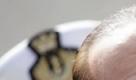 Die Lider neu fixiert, Hals und Wangen straffer, die Tränensäcke sind weg. Italiens Regierungschef Silvio Berlusconi unternimmt eine Menge, um mit seinem 75 Jahren jünger zu wirken. Foto: dapd