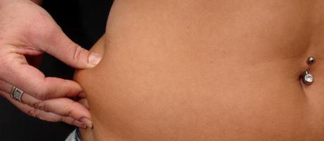 Dick trotz Bulimie? (Foto)