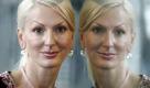 Nick zum Thema Botox: Man kann nicht mitreden, wenn man es nicht selbst ausprobiert hat. Foto: dpa
