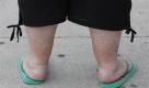 ARCHIV - Eine uebergewichtige Frau steht am  22. Juli 2009, am Alexanderplatz in Berlin. Die meisten erwachsenen Deutschen schleppen jahraus, jahrein Uebergewicht mit sich herum - jede fuenfte Frau und jeder fuenfte Mann ist sogar fettleibig.  Statt notgedrungen zu hungern, entschliessen sich immer mehr Wohlstandsbuerger zum freiwilligen Fasten. (AP Photo/Franka Bruns) ---FILE - An obese woman visits Alexanderplatz in Berlin, in this July 22, 2009 file photo. (AP Photo/Franka Bruns) ** zu unserem Korr. ** Foto: ap