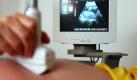 Seit 1979 ist sie Routine - dank der Ultraschalluntersuchung können etwa Herzfehler eines Ungeborenen erkannt werden. (Bild: Pleul/dpa/tmn) Foto: dpa