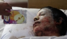 Bei dem Luftangriff in Afghanistan sind nicht nur Taliban getötet und verletzt worden. Auch Zivilisten sind unter den Opfern, die in einem Krankenhaus in Kabul versorgt werden. Foto: dpa