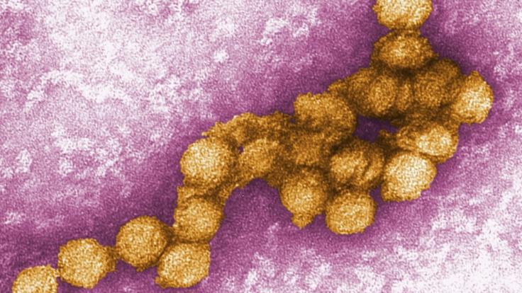 Dieses Foto zeigt eine elektronenmikroskopische Aufnahme des West-Nil-Virus. Vier Wochen nach dem bundesweit ersten Fall ist das West-Nil-Virus (WNF) erstmals in Mecklenburg-Vorpommern aufgetaucht.