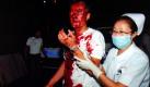 Ein verletzter Mann in der Obhut einer Krankenschwester nach den Unruhen im chinesischen Urumqi. Erneut gab es dort Zusammenstöße zwischen der ethnischen Minderheit der Uiguren und Han-Chinesen. Die verschärften Sicherheitsvorkehrungen durch die Obrigkeit reichten offenbar nicht aus. Foto: ap