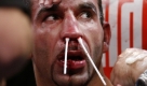 In den Pausen versucht sein Team, die Blutung zu stoppen. Am Ende war nahezu der komplette Ringboden blutverschmiert. Das sieht aus, als sei hier ein Ochse gekpft worden, beschrieb Jean Marcel Nartz, Technischer Leiter im Universum-Boxstall, die Szenerie. Foto: dpa