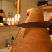 Dem eigenen Körper fremd (Foto)