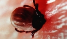 Wenn eine Zecke sich festgebissen hat, ist das ärgerlich. Über das Blutbild lässt sich feststellen, ob sie als Andenken auch Borreliose-Bakterien oder das Virus einer Frühsommer-Meningoenzephalitis (FSME) hinterlassen hat. Foto: dpa
