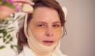 Elke ist 43 - findet aber, dass sie viel älter aussieht. Ein Lifting verleiht ihrem Gesicht neue Frische. Dafür muss sie wochenlang von ihrer Familie getrennt in der Klinik bleiben. Foto: RTL2