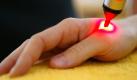 ARCHIV - ILLUSTRATION - Mittels Druck und Laserlicht auf einen Akupunktur-Punkt der Hand wird eine Laser-Akupunktur bei einem Patienten durchgeführt. Vor 50 Jahren - am 16. Mai 1960 - wurde der erste Laser präsentiert. Foto: Frank Rumpenhorst (zu dpa-Korr vom 10.05.2010) +++(c) dpa - Bildfunk+++  Foto: dpa