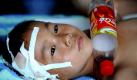 In this Saturday July 31, 2010 photo released by China's Xinhua news agency, an injured boy receives medical treatment in a hospital in Yicheng, north China's Shangxi province. A blast at a workers' dormitory killed at least 17 people in a northern city with a history of deadly mine accidents. The explosion in the early morning hours on Saturday was blamed on explosives that had been illegally hidden in the area, Xinhua reported, citing a senior official with the mine's owner, Yangquan Coal Industry (Group) Co. Ltd. (AP Photo/Xinhua/Yan Yan) ** NO SALES ** Foto: ap