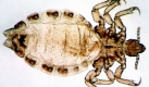 Kopflaus (Foto)