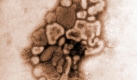 Virus vor ber 30 Jahren: Das eingefrbte Foto zeigt den Schweinegrippevirus von 1976, der in den USA damals Panik auslste, obwohl sich der Virus nicht ausbreitete. Foto: dpa