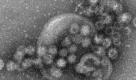 Elektronenmikroskopische Aufnahme von Noroviren. Der Verdacht des Norovirus in Hessen hat sich bestätigt. Foto: dpa