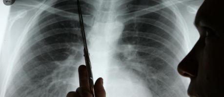 Krebsdiagnose  (Foto)