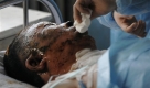 Nach der schweren Minenexplosion in China wird dieser verletzte Arbeiter in einem Krankenhaus behandelt. Foto: ap
