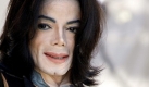 Michael Jacksons Haut wurde immer bleicher. Als Grund nannte er die Weißfleckenkrankheit. Foto: dpa