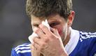 Schalkes Klaas-Jan Huntelaar hat sich gegen Larnaca eine blutige Nase geholt. Foto: Friso Gentsch Foto: dpa
