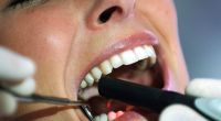 Regelmäßige Kontrolle beim Zahnarzt ist wichtig.